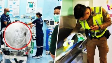 Photo of 男子机场突痉挛露馅 吞255颗毒胶囊闯关失败