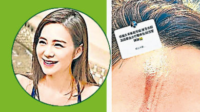 Photo of 《爱．回家》梁茵险毁容 遭电发棒烫伤