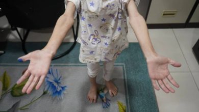 Photo of 遭虐华裔女童住院治疗 兄妹由祖父母照顾