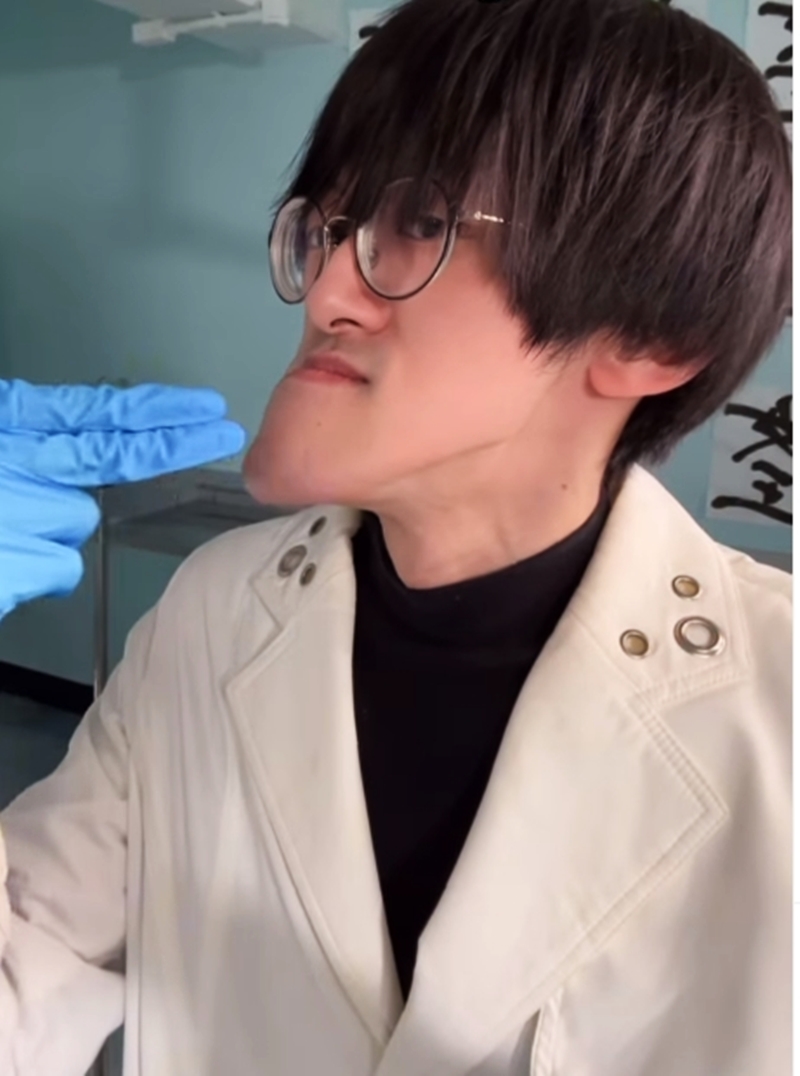 走进牙科诊所拍摄X光，想一探自己下巴骨骼的真面目，结果令他自己都惊呼“太夸张”