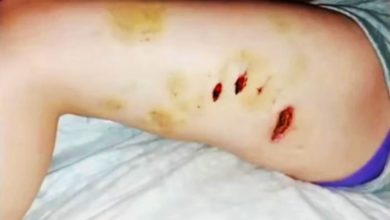Photo of 遭鳄鱼咬脚拖下水 15岁少女出拳抵抗逃出鳄口