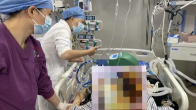 Photo of 女郎坐11小时长途飞机 下机10分钟昏迷 不治身亡