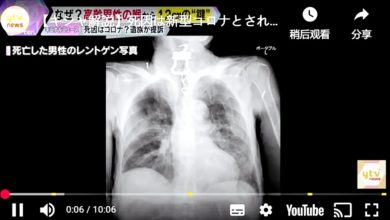 Photo of 老翁“喉咙痛”确诊冠病亡 X光竟发现钥匙卡喉咙