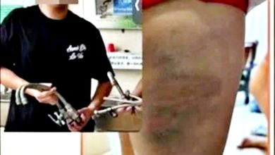 Photo of 9岁童被鞭打腿瘀青 警方追捕31岁舅舅