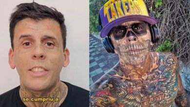 Photo of 洗掉全身95%刺青 男子重生痛喊 “比刺青痛三倍!”