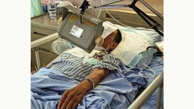 Photo of 骑摩多被横空绳索割颈 男喉部“重建”挽回性命