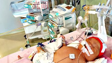 Photo of 早产肺炎肺动脉高压 男婴急需9万医疗费