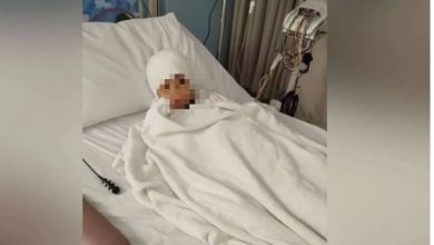 Photo of 姐拒爱后患癌弟被攻击致脑震荡 霸凌者则因未成年不处分