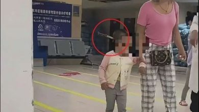 Photo of 云南3岁女童头插水果刀 淡定进医院吓坏网民