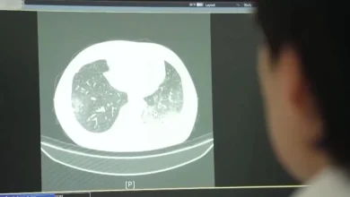Photo of 空调吹了一周突然白肺 夏季警惕这个隐匿“杀手”