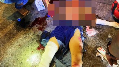 Photo of 晚宴回程遭撞后逃 少年重伤险丧命
