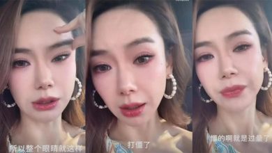 Photo of 眉毛抬不动认肉毒注射过量 戚薇医美翻车反倒更圈粉