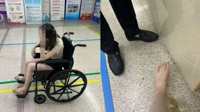 Photo of 五星级酒店用餐惊魂 女子惨被蜈蚣咬伤脚趾