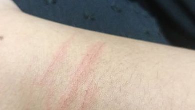 Photo of 5男生校内拦12岁女生勒索被拒 1男竟多次挥刀割伤受害者手部
