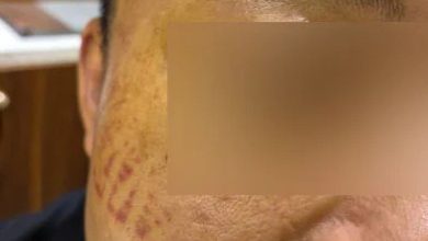 Photo of 疑因财务纠纷   4中国男被非法禁锢   惨遭虐打 钉脚 烧指等酷刑折磨