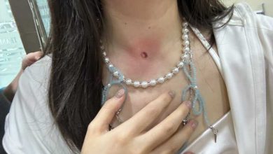 Photo of 中女游客:偕友到沙巴网红景点马银行打卡    颈部遭不明人士以弹弓射物击伤