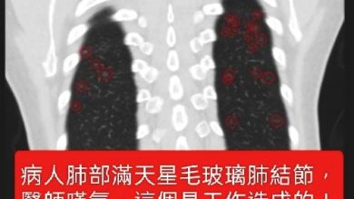 Photo of 六旬妇肺变“满天星”毛玻璃 医生：工作环境导致
