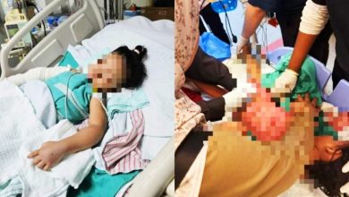 Photo of 2岁女童保姆家遭严重烫伤案 警方：保姆已认罪 延后下判