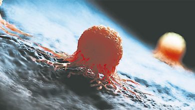 Photo of 神经内分泌肿瘤难察觉 数症状速就医