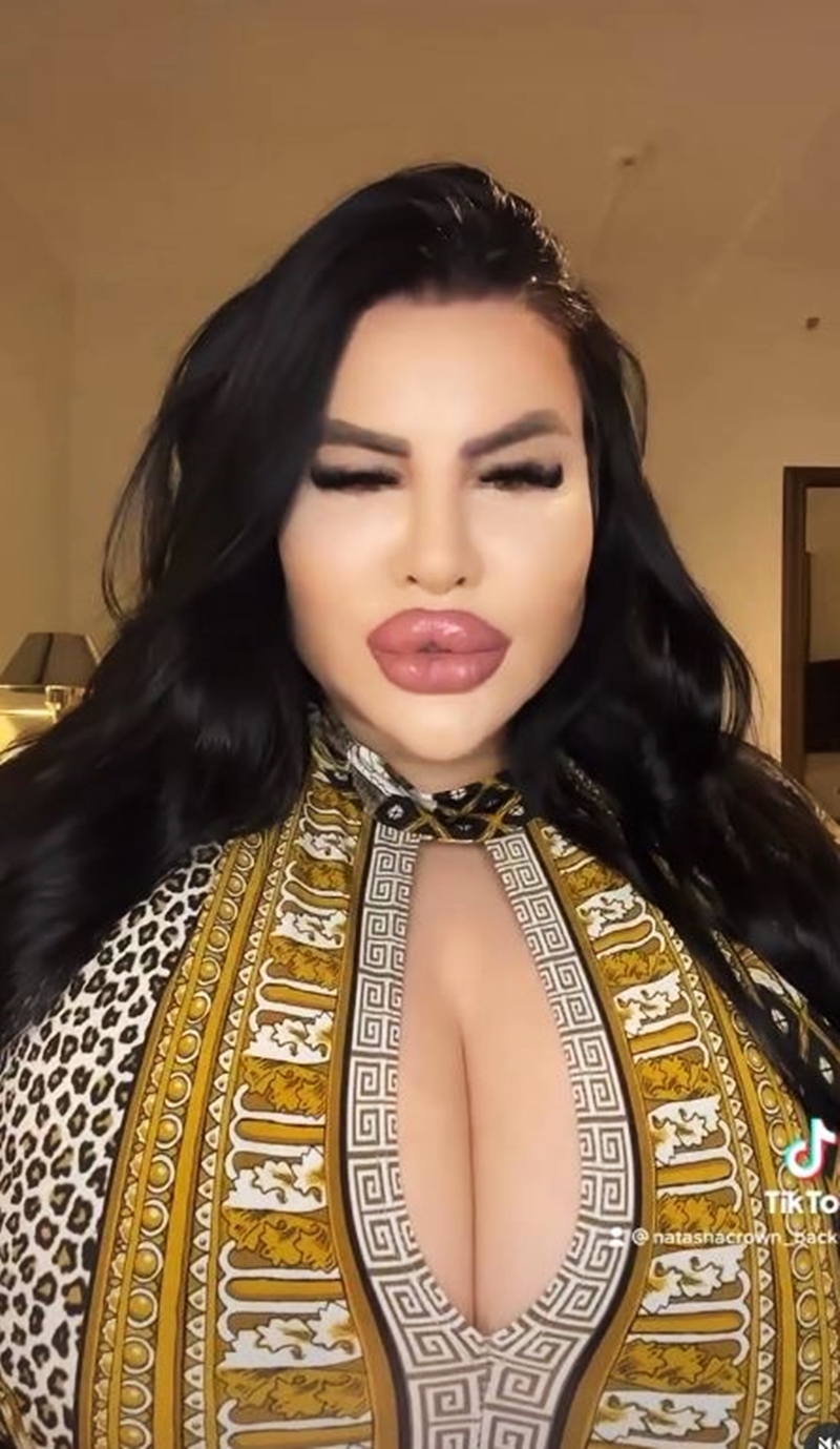 克朗还做了隆乳、肉毒桿菌等多项手术