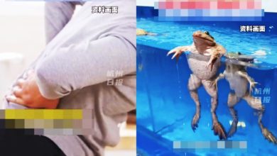Photo of 生吞8活蛙可治腰痛？ 老妇误信偏方染寄生虫