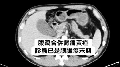 Photo of 腹泻腰酸别轻忽 男子确诊胰脏癌末期