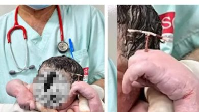 Photo of “我赢了！” 男婴手握母避孕器降生 离奇一幕掀热议！