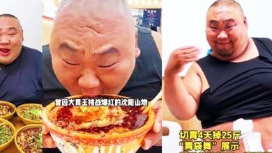 Photo of 吃播网红动缩胃手术减重 坦言不切恐仅剩3年寿命
