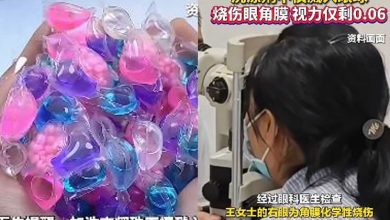 Photo of 撕开粘连洗衣凝珠突爆裂 女灼伤眼险失明