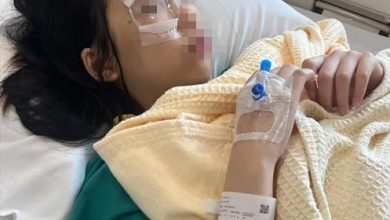 Photo of 女童上私校做实验突发爆炸受伤 脸部 眼睛受伤留下永久性疤痕