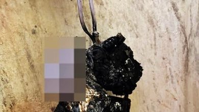Photo of 充电宝充电爆炸 女子手臂烧伤