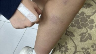 Photo of 3楼拖到1楼 头发被剪 台女学生遭学长霸凌