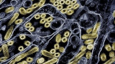 Photo of 老翁染H5N5死亡全球首例 卫生部:人类感染风险仍低