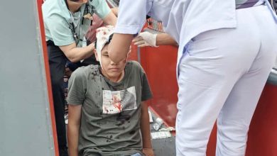 Photo of 少年闯儿童旋转梯 撞钢梁头破血流送院