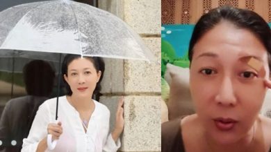 Photo of 遭树叶割伤险毁容！ 吴绮莉惊呼“眼球差点完蛋”