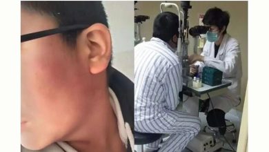 Photo of 一掌毁视力!13岁男生遭班主任掌掴 眼睛近乎全盲
