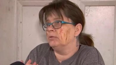 Photo of 外出寻狗瞬间遭猛兽扑咬！女全身血惊呼：幸好狗没事