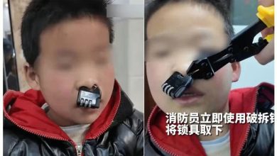 Photo of 男童鼻梁套密码锁 消防员惊问：还玩吗？