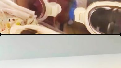 Photo of 超早产女婴连汐悦 医生:情况持续好转