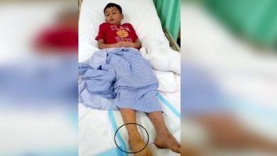 Photo of 6公尺巨蟒紧缠10岁男童全身咬其脚  舅舅哥哥用鱼叉巴冷刀撬蛇口救一命