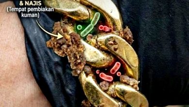 Photo of 缝隙藏残留物易食物中毒 公卫组织：小贩备食禁戴手链
