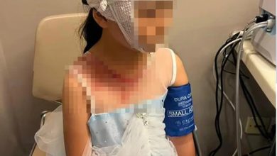 Photo of 7岁女童玩跳跳床头破血流受惊吓    女童母不滿游乐场只赔医药费172新元  免费玩10次