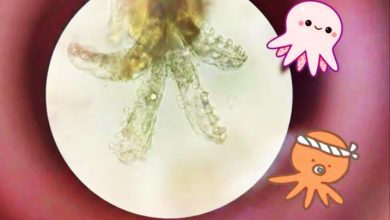 Photo of 红疹像砂纸 还发痒？专家教你辨认蠕形螨虫症