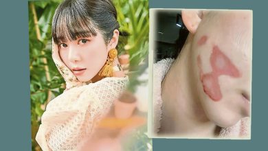 Photo of 前AOA珉娥医美惨遭毁容