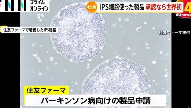 Photo of 日本批准两项iPS细胞再生医疗产品 创全球首例