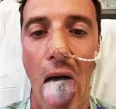 Photo of 男性也要警惕HPV 英男分享头颈癌经历：差点失去舌头！
