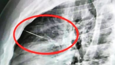 Photo of 下班躺床险送命 泰男胸口卡7公分缝衣针
