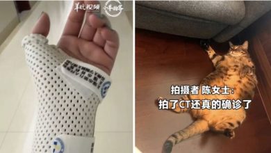 Photo of 医生都傻眼! 被15公斤重猫压着睡  女醒来竟手腕骨折