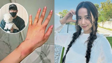 Photo of BLACKPINK Jisoo亲哥卷性侵案 妻全身伤家暴照曝光