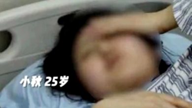 Photo of 滑手机踩空重摔 25岁女恐瘫痪